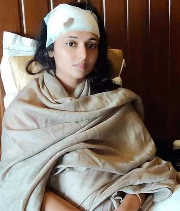 A picture of Mani Bhattacharya after being hit by a stone during the shoot of Mera Bharat Mahaan