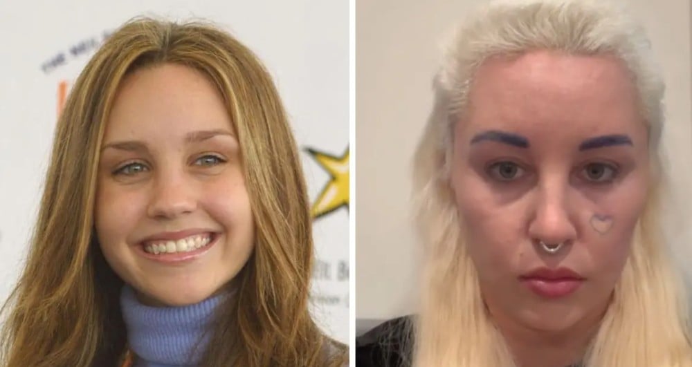 Amanda Bynes before (left) and after (right) plastic surgery look