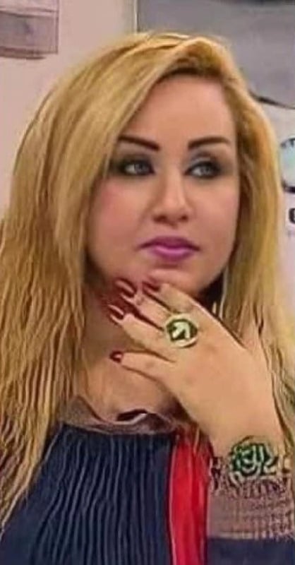 Dalia Naeem before her surgeries