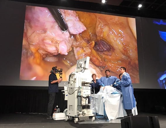 Dr. Shailesh Puntambekar while performing a live surgery at a workshop