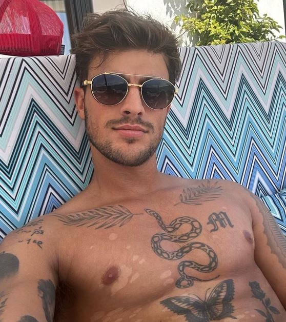 Luca Bish posing for a photo with skin patches