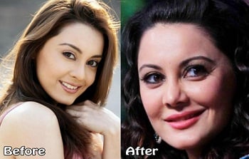 Minissha Lamba’s before and after picture