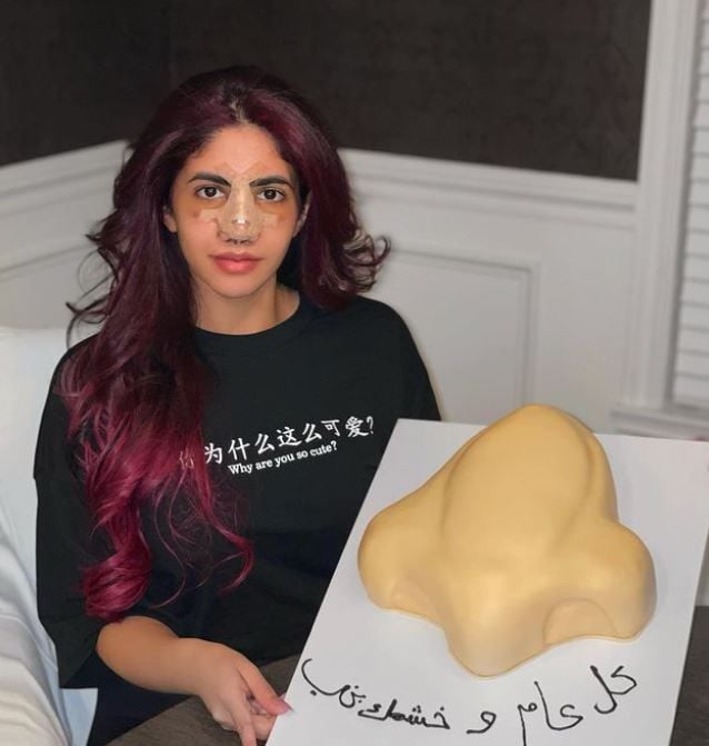 Noor Stars revealed her Nose job