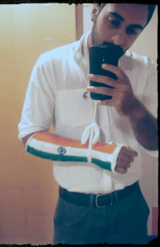 Rinosh George fractured his hand in an accident in 2015