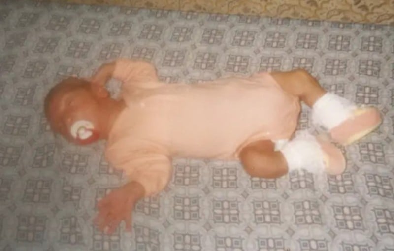 Rumeysa Gelgi at the age of 10 days