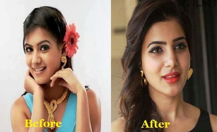 Samantha Ruth Prabhu’s before and after photo