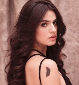 Sidhika Sharma Birthmark