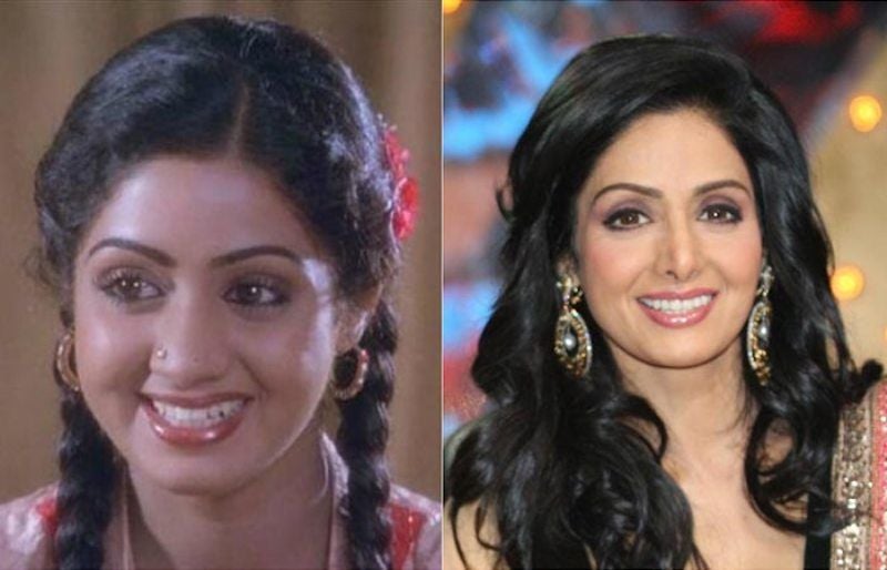 Sridevi Plastic Surgery